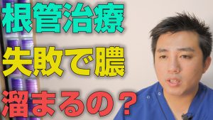 根管治療の失敗で膿が溜まるのか？【大阪市都島区の歯医者 アスヒカル歯科】